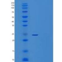 小鼠胰岛素样生长因子结合蛋白6(IGFBP6)重组蛋白His tag