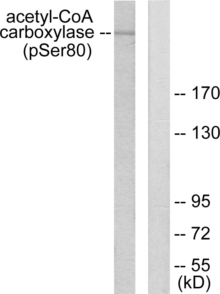ACACA Antibody (Phospho-Ser80) (OAAF00033) in 293 using Western blot.