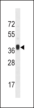 MNX1 antibody - center region (OAAB11890) in Mouse Liver using Western Blot