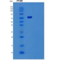 人肌肽二肽酶1重组蛋白