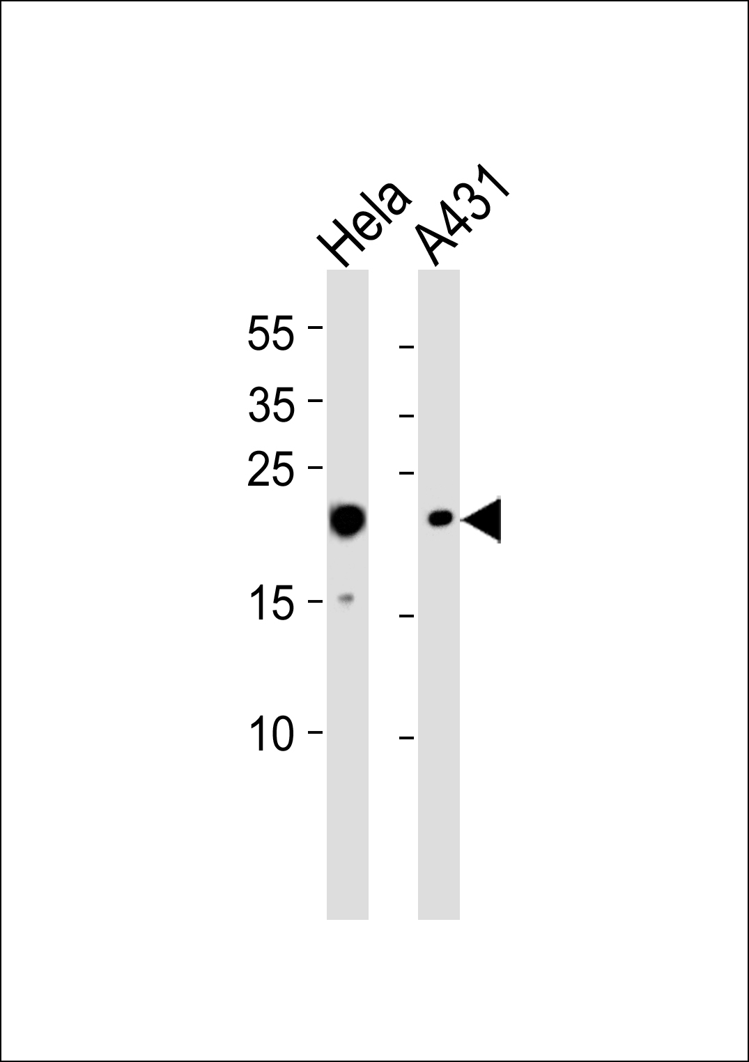 TOMM20 Antibody (OAAB18573) in Hela, A431 cell line (from left to right) using Western Blot