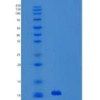 人小泛素相关修饰蛋白3(SUMO3)重组蛋白C-6His