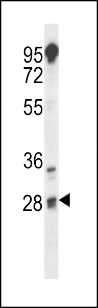 TSPY1 Antibody - C-terminal (OAAB17814) in LNCAP cell line lysate using Western Blot