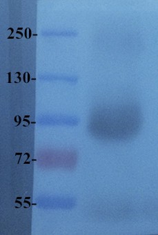 PIGR Antibody (OABI00022) in Human breast cancer tissue using Western Blot