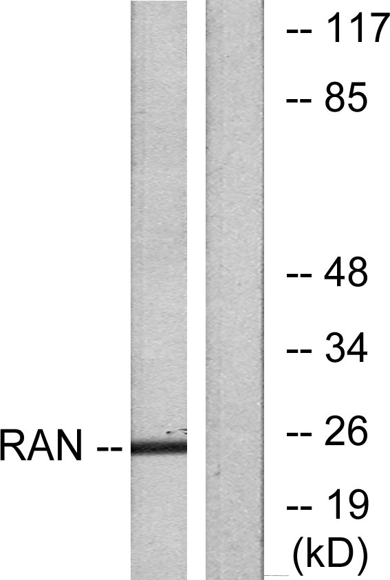 RAN Antibody (OAAF01912) in LOVO using Western blot.
