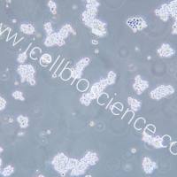 NCI-H716/NCI-H716细胞/人结直肠腺癌细胞/STR鉴定/镜像绮点（Cellverse）