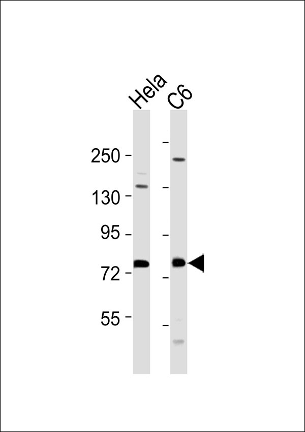 TLK1 Antibody (OAAB19796) in Hela whole cell lysates, C6 whole cell lysates using Western Blot