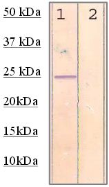 Rabbit Anti-Rho Antibody (Phospho-S188) (OAAI00595) in conditioned MCF-7  using Western Blot.
