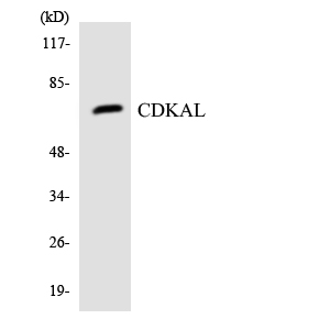 CDKAL Antibody (OAAF06214) in HUVECcells using Western blot.