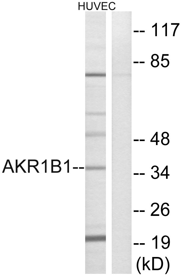 AKR1B1 Antibody (OAAF03258) in HuvEc using Western blot.