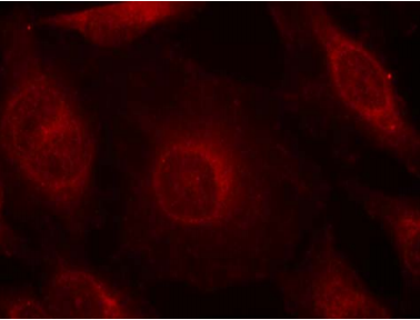 AKT1 Antibody (OAEC00295) in HeLa using Immunofluorescence