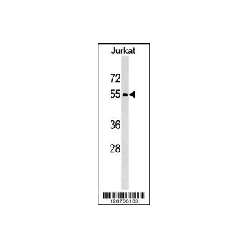 PNMA3 antibody - C - terminal region (OAAB13330) in Jurkat using Western Blot