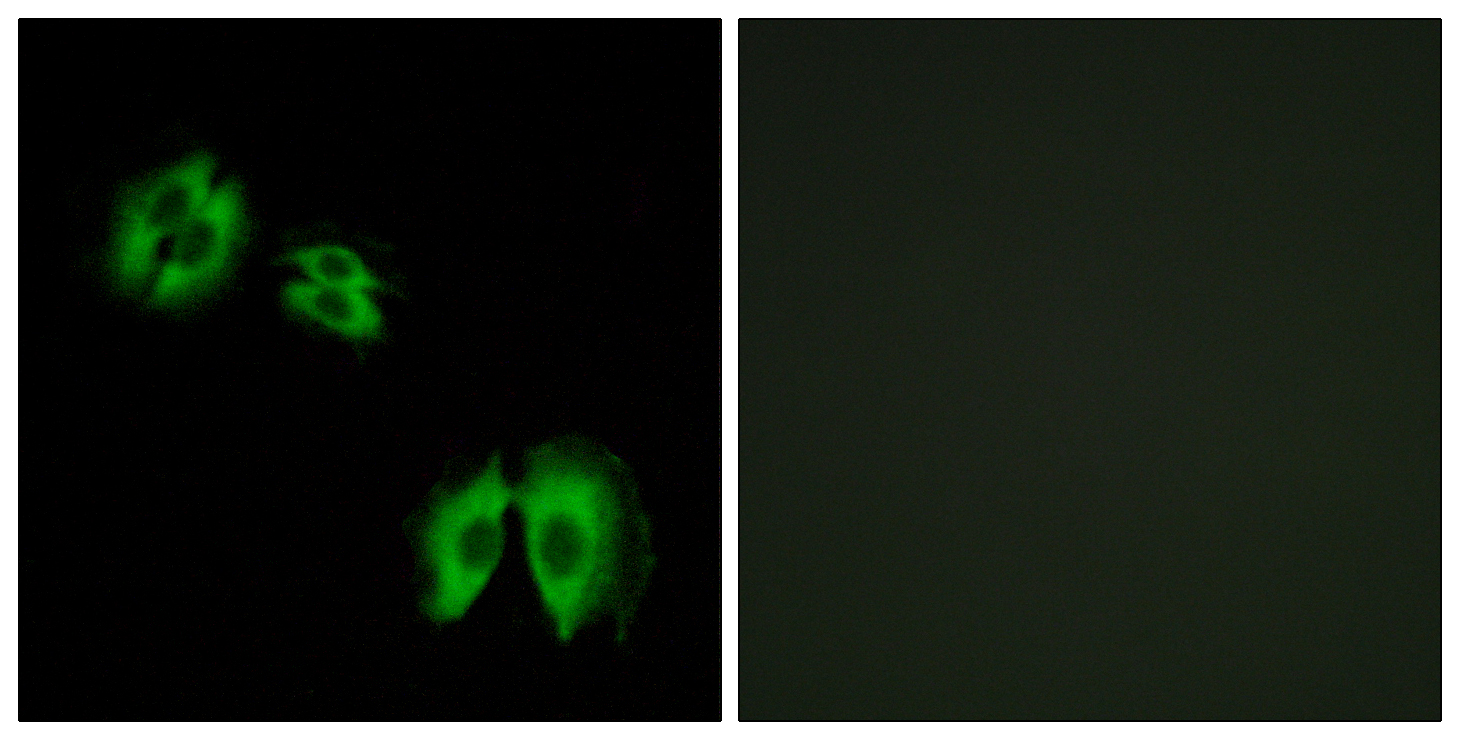 B3GALT2 Antibody (OAAF03364) in A549 using Immunofluorescence.