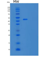 小鼠疱疹病毒进入介质重组蛋白