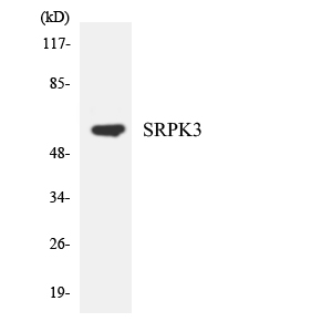SRPK3 Antibody (OAAF07169) in HeLa using Western blot.