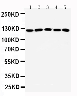 ST5 Antibody - middle region (OABB01451) in Rat Testis Tissue Lysate, A431 Whole Cell Lysate, HELA Whole Cell Lysate, COLO320 Whole Cell Lysate, NIH Whole Cell Lysate using Western Blot
