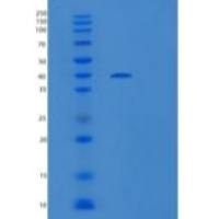 人双糖链蛋白聚糖(BGN)重组蛋白C-6His
