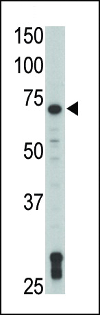 TXK antibody - N - terminal region (OAAB17235) in Jurkat using Western Blot