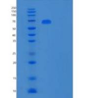 人多聚免疫球蛋白受体(PIGR)重组蛋白