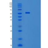 人细胞程序性死亡蛋白1配体1(PDL1)重组蛋白C-Fc