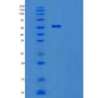 人细胞程序性死亡蛋白1配体1(PDL1)重组蛋白C-Fc