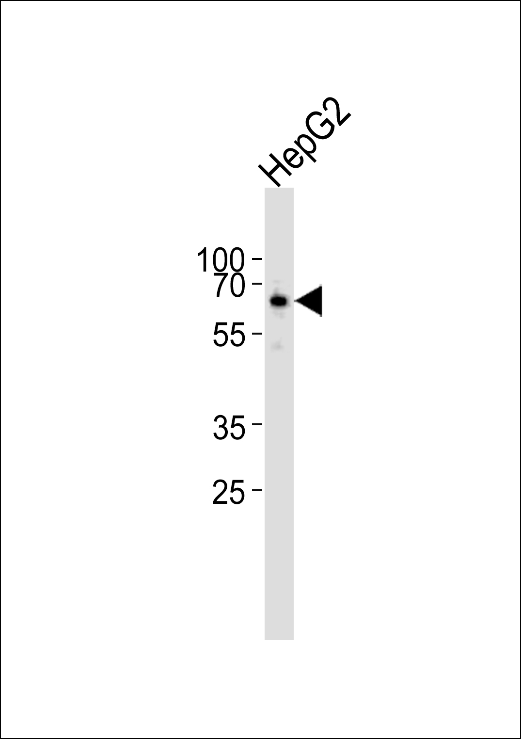 GATB Antibody - N-terminal region (OAAB18756) in HepG2 cell line using Western Blot