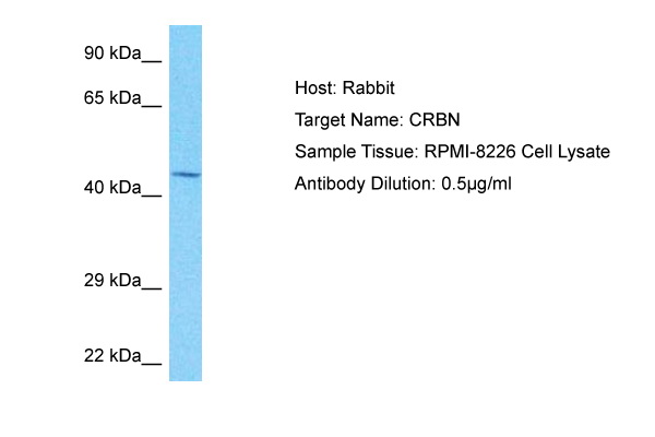 NKX31 Antibody (ARP75002_P050) in Human PANC1 Whole Cell using Western Blot