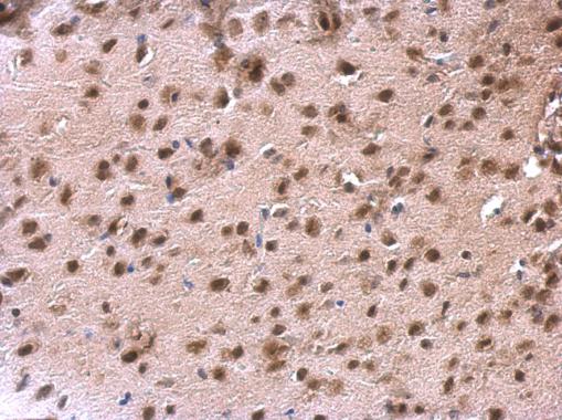 DDX1 Antibody - middle region (OAGA02498) in Mouse fore brain using Immunohistochemistry