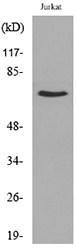 NFB-p65 Antibody (Acetyl-Lys218) (OAAF08229) in Jurkat using Western Blot