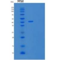 人cAMP依赖性蛋白激酶1α/PRKAR1A重组蛋白C-6His