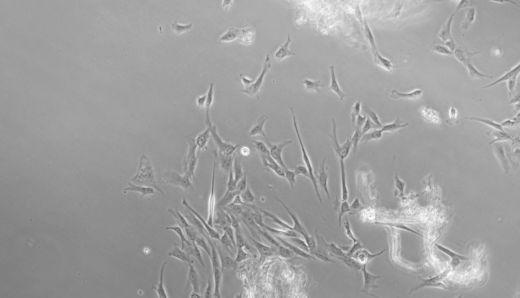 人脐带来源间充质干细胞分离培养分享