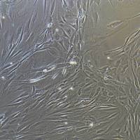 人卵巢癌相关成纤维细胞永生化/免疫荧光鉴定