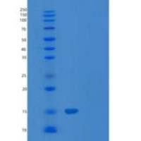 人髓磷脂蛋白P0样1/MPZL1重组蛋白C-6His