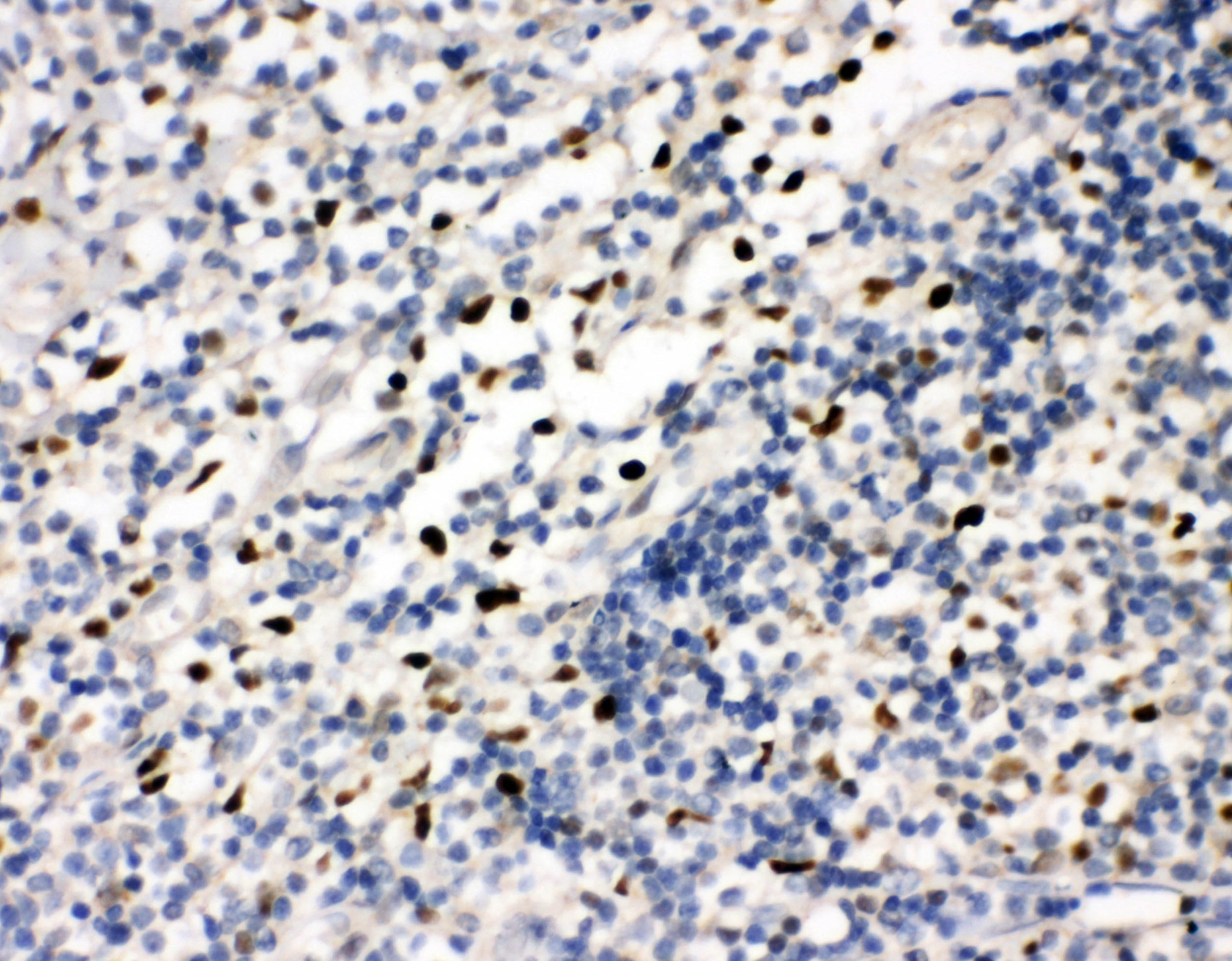 FLI1 Antibody - N-terminal region (OABB01342) in Human Tonsil Tissue using Immunohistochemistry