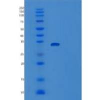 人表皮生长因子(EGF)重组蛋白Fc Tag