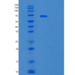 小鼠酪氨酸蛋白激酶受体TYRO3/Dtk重组蛋白C-mFc产品图