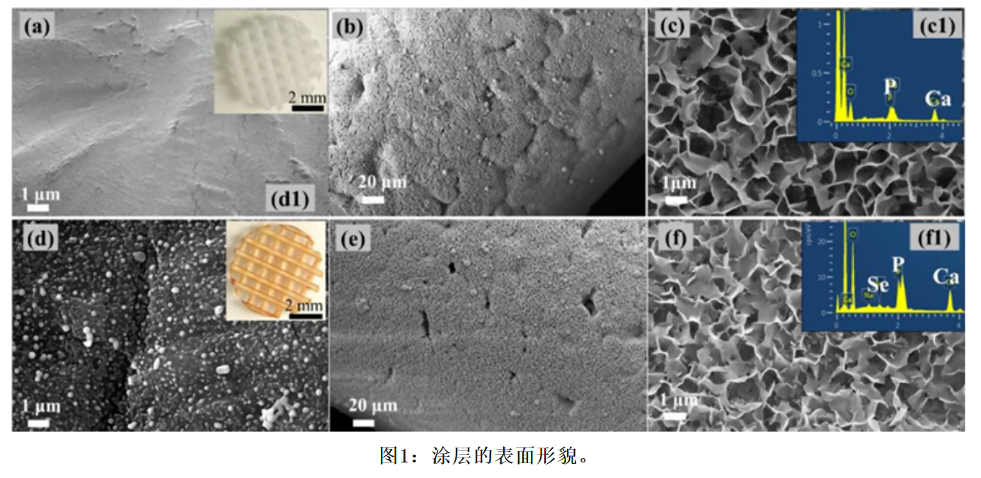 Acta Biomaterialia (IF=9.7) 具有层状抗菌纳米硒颗粒的磷酸钙涂层3D打印支架在临界尺寸缺陷中可增强骨形成