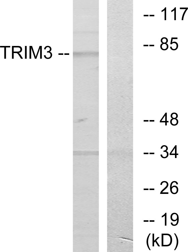 TRIM3 Antibody (OAAF02050) in COLO using Western blot.