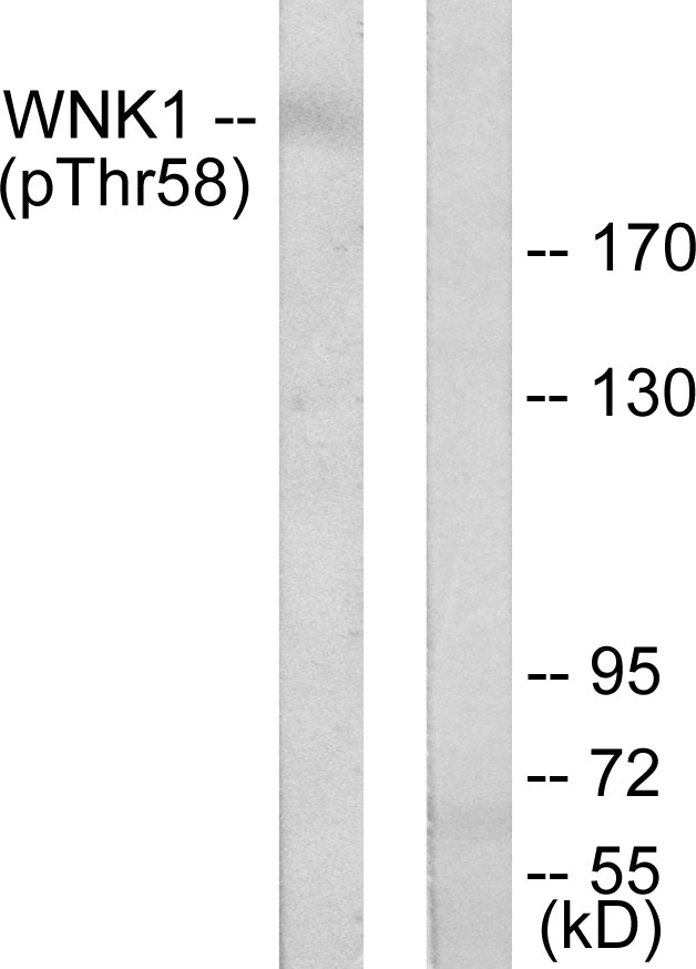 WNK1 Antibody (Phospho-Thr58) (OAAF07338) in 293 using Western Blot