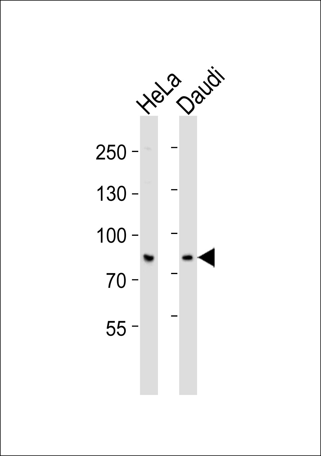 SP3 Antibody (OAAB18545) in HeLa, Daudi cell line (from left to right) using Western Blot