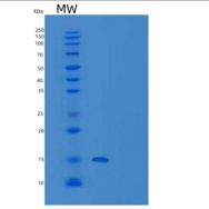 人CD160分子(CD160)重组蛋白C-6His