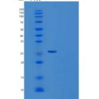 人含Ly6/PLAUR结构域的蛋白3重组蛋白