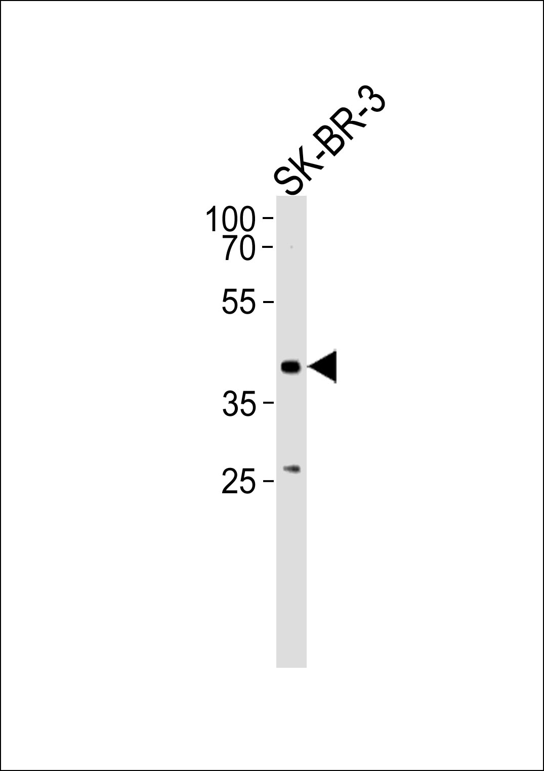 ELK3 Antibody (N-term) (OAAB11891) in SK-BR-3 using Western Blot