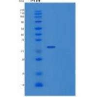 人激肽释放酶10(KLK10)重组蛋白C-6His