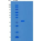 人微纤丝关联蛋白4(MFAP4)重组蛋白C-6His