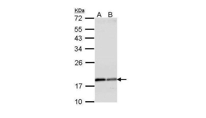 ARF1 antibody (OAGA01008) in A431, H1299  using Western Blot