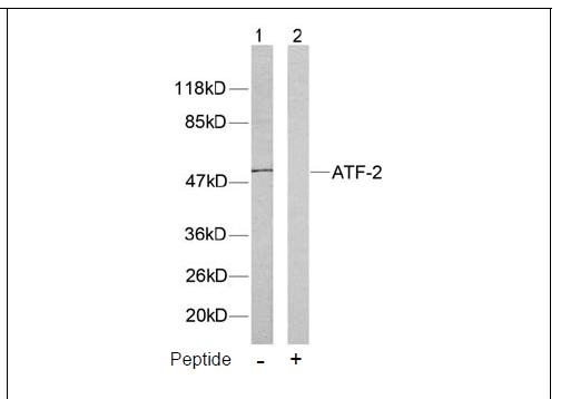 ATF-2 (Ab-71 or 53) Antibody (OAEC00381) in Human Hela using Western Blot