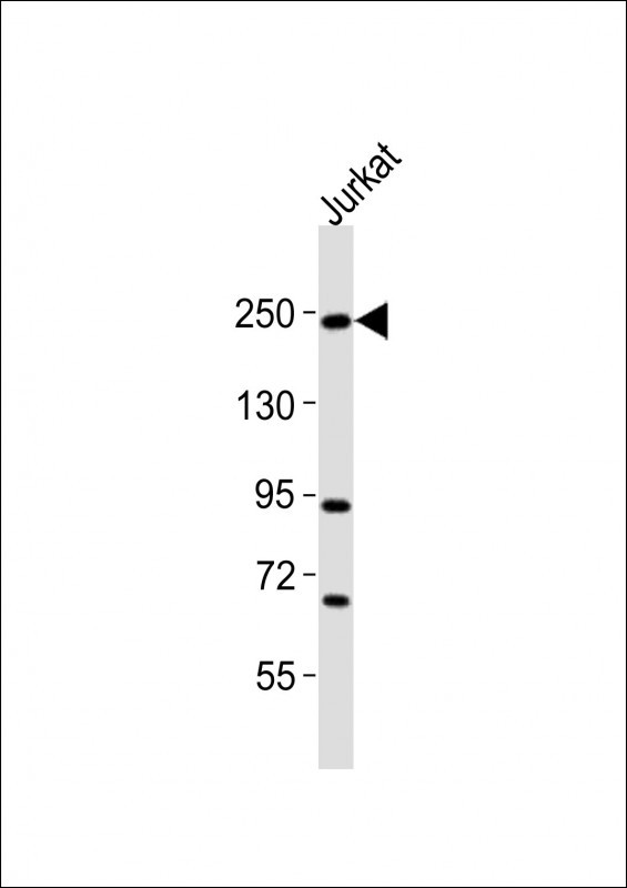 DOCK2 Antibody - C-terminal region (OAAB19110) in Jurkat whole cell lysates using Western Blot