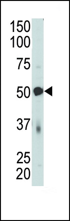 PDK4 Antibody (C-term) (OAAB16777) in mouse skeletal muscle tissue using Western Blot