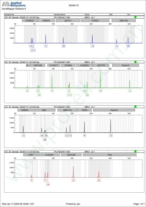 KYSE-30(人食管鳞癌细胞)